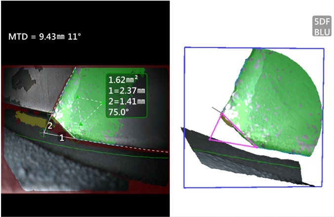 使用3D点云图测量叶尖掉角的应用案例